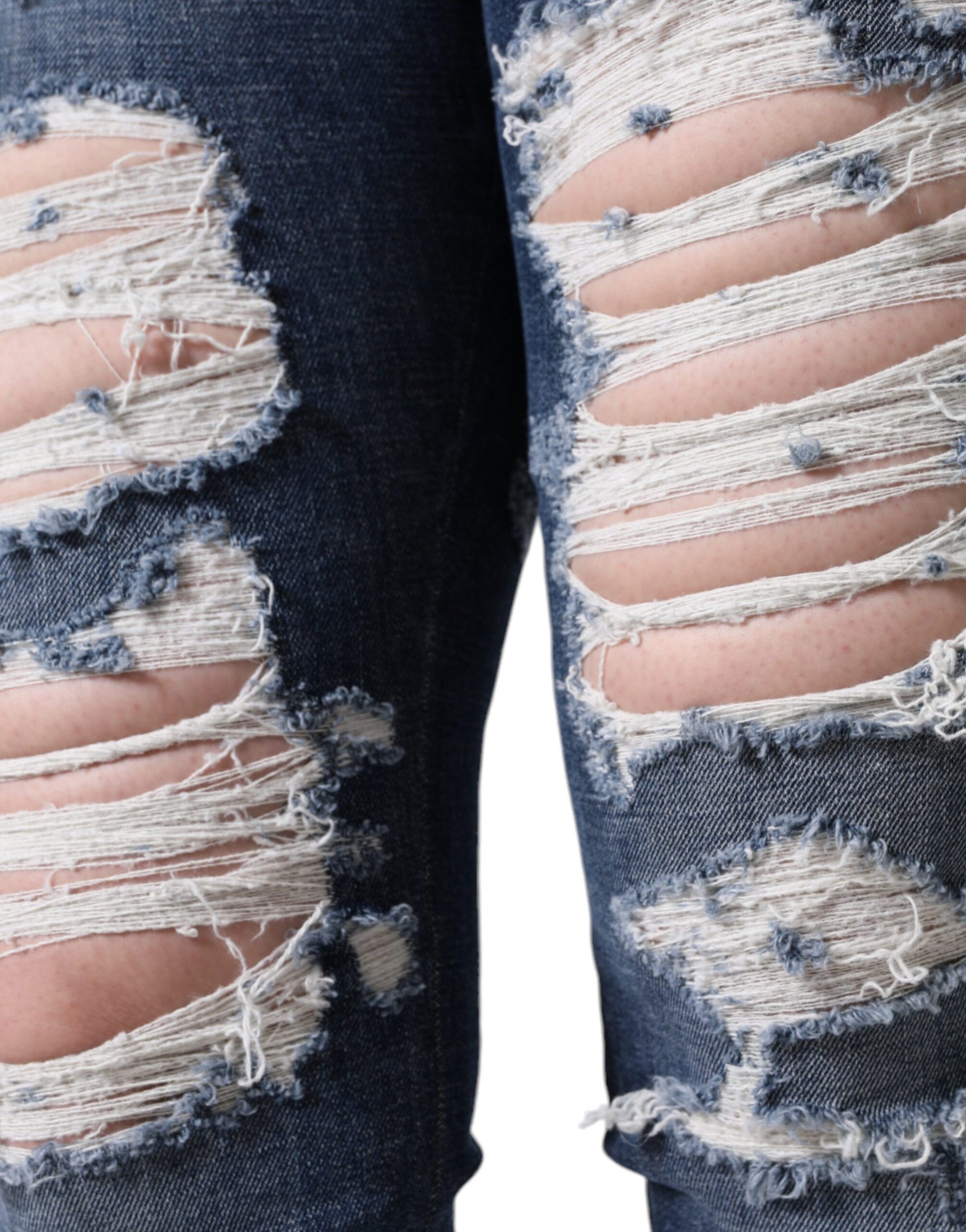 Blue Cotton Stretch Tattered Skinny Jeans