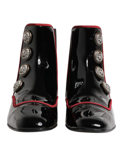 Black Jackie Buttoned Chelsea Boots Shoes